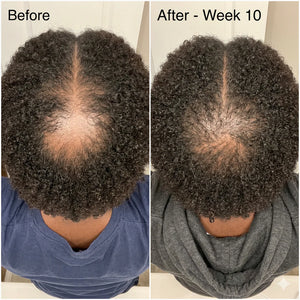 ScalpReset™ Scalp Serum
